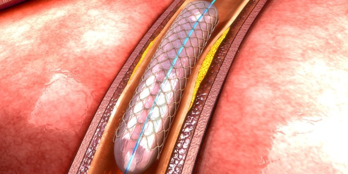 Navigating Vascular Health with Excellence: Peripheral Angiography in Jaipur
